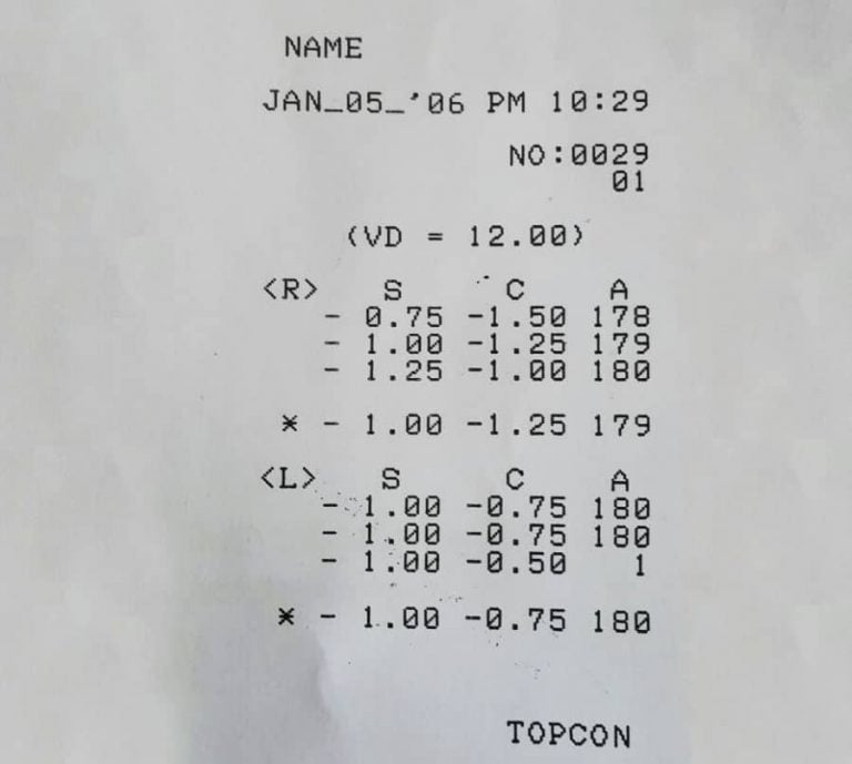 Göz-Ölçüm-Değerleri-En-Fazla-Kaç-Olmalıdır-768x689
